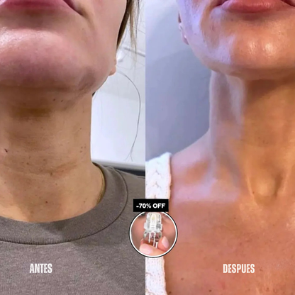 Glov Skin®- Rejuvenece tu piel sin clínicas ni agujas dolorosas